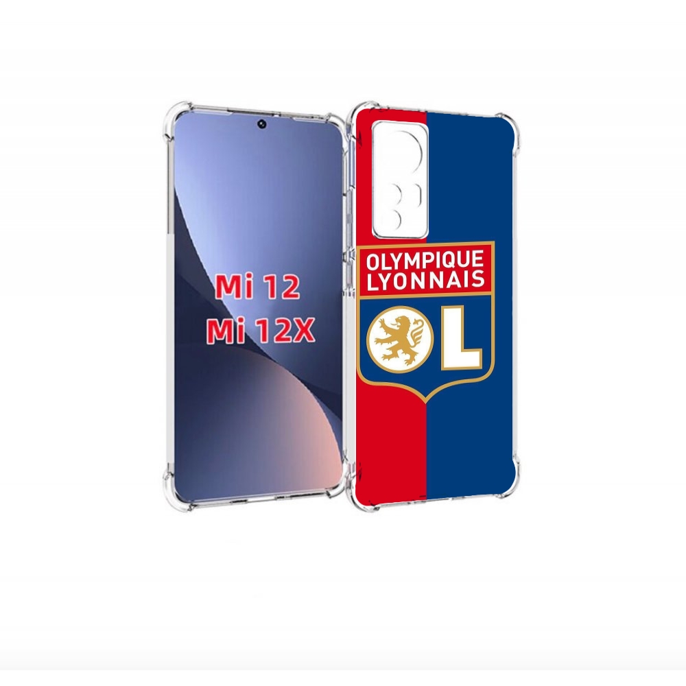 

Чехол бампер MyPads фк лион эмблема для Xiaomi 12., Прозрачный, Tocco