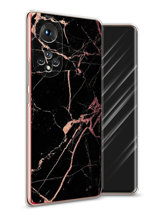 

Чехол Awog на Honor 50 "Мрамор розовое золото", Черный;розовый, 6105450-3
