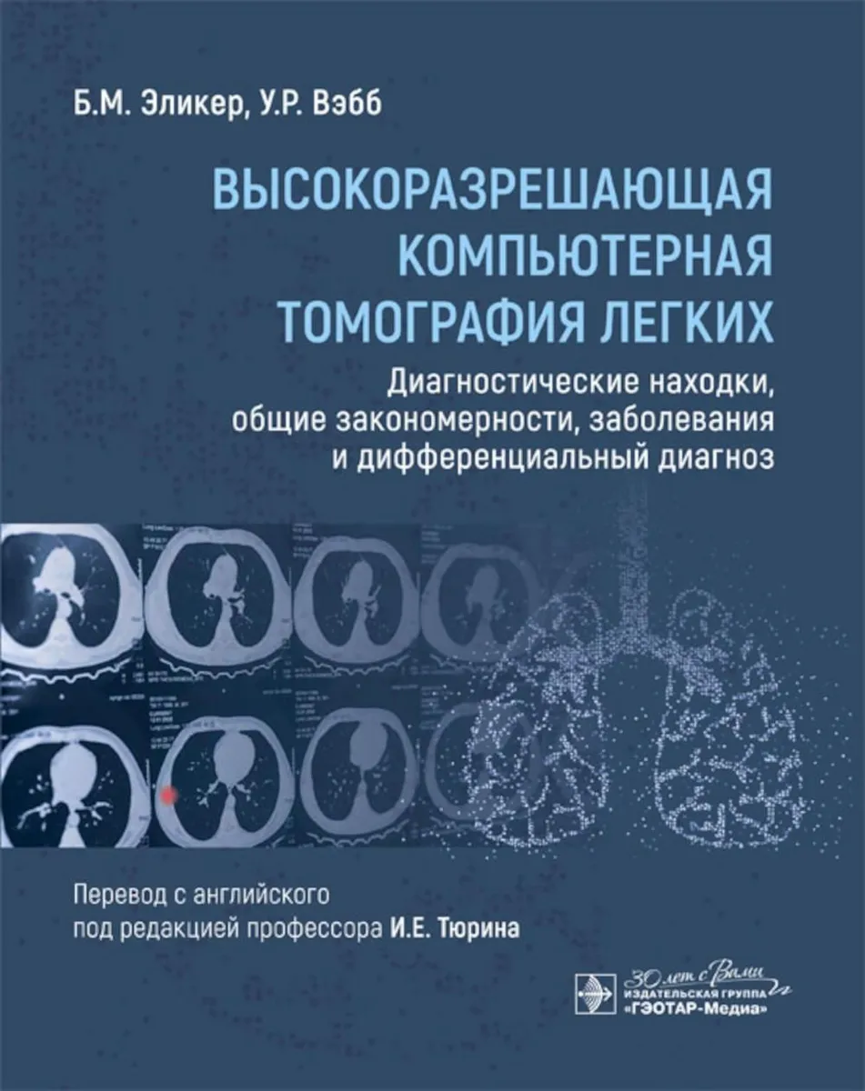

Высокоразрешающая компьютерная томография легких, ОБРАЗОВАНИЕ И НАУКА