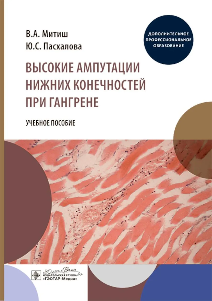 

Высокие ампутации нижних конечностей при гангрене, ОБРАЗОВАНИЕ И НАУКА