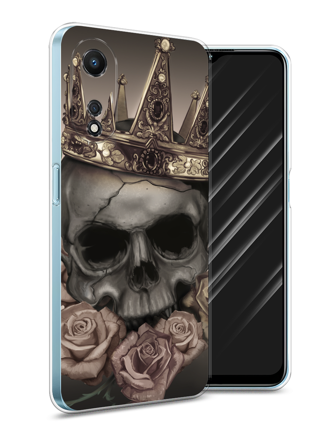 

Чехол Awog на Oppo A58 5G "Красные губы", Черный;бежевый;красный, 2512450-7