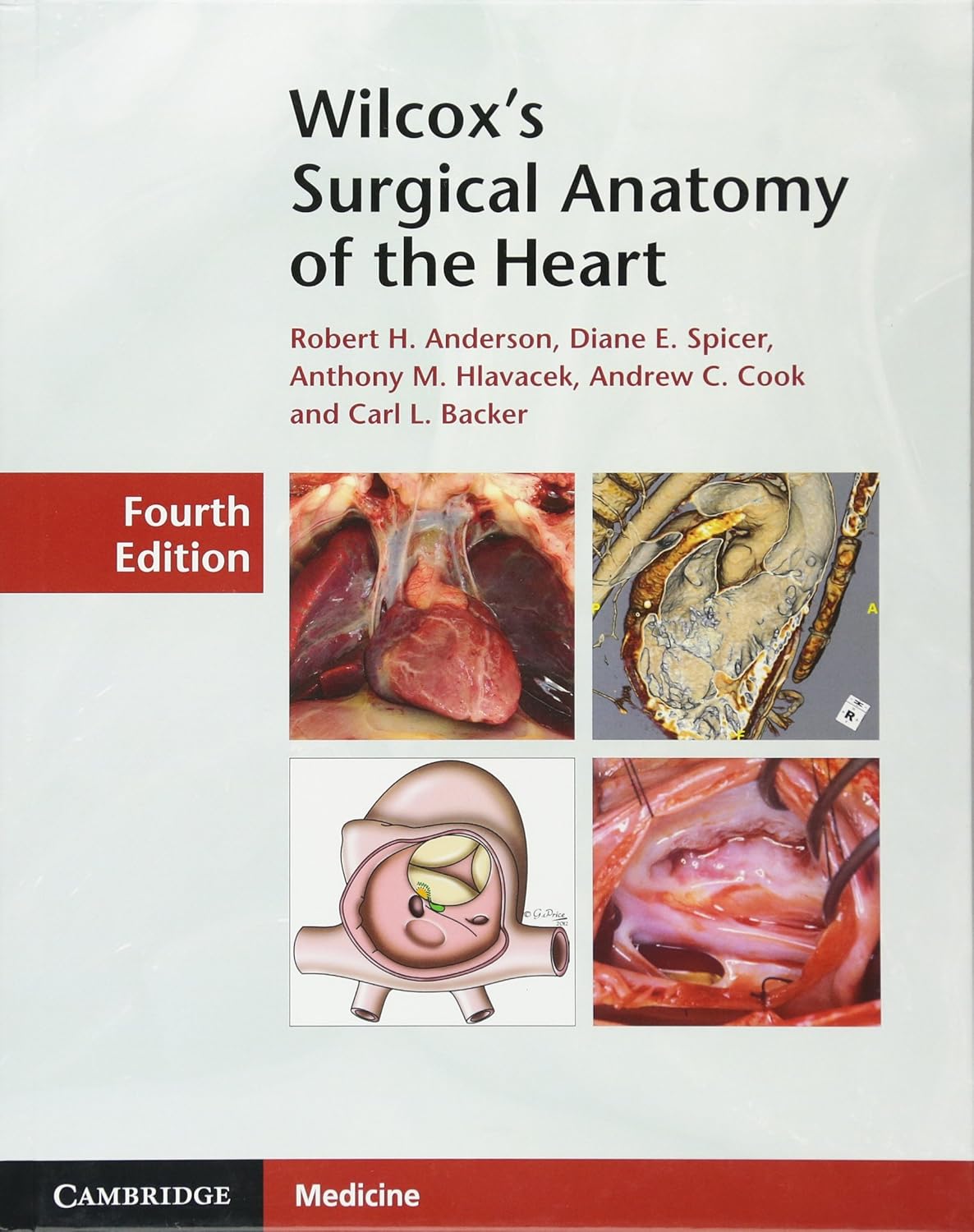 

Wilcox's Surgical Anatomy of the Heart. Andrew C. Cook, Anthony M. Hlavacek, Carl L. Backe
