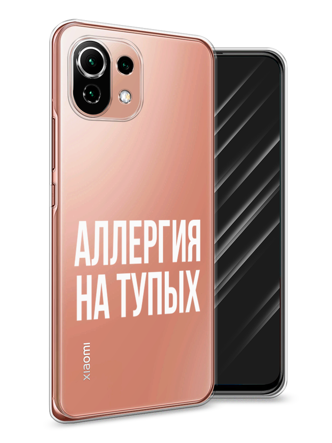 

Чехол Awog на Xiaomi Mi 11 Lite/5G NE "Аллергия на тупых", Разноцветный, 311750-6