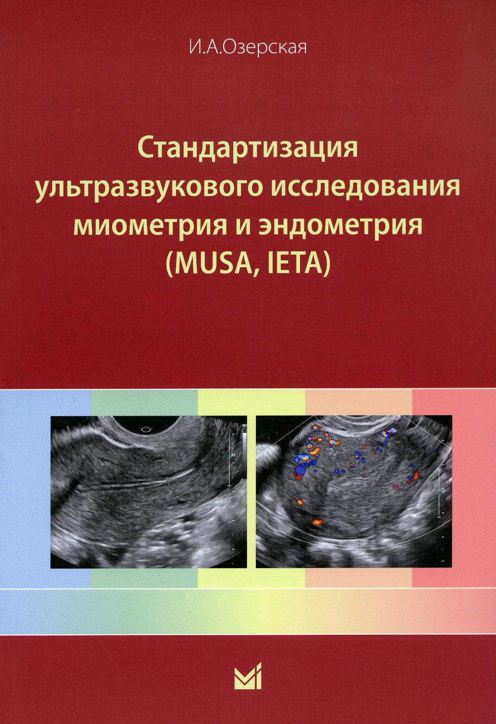 

Стандартизация ультразвукового исследования миометрия и эндометрия (MUSA, IETA)