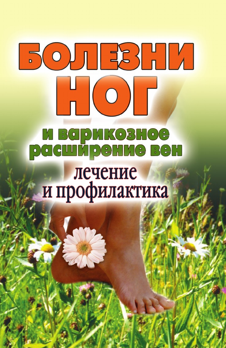 

Болезни ног и варикозное расширение вен. Лечение и профилактика