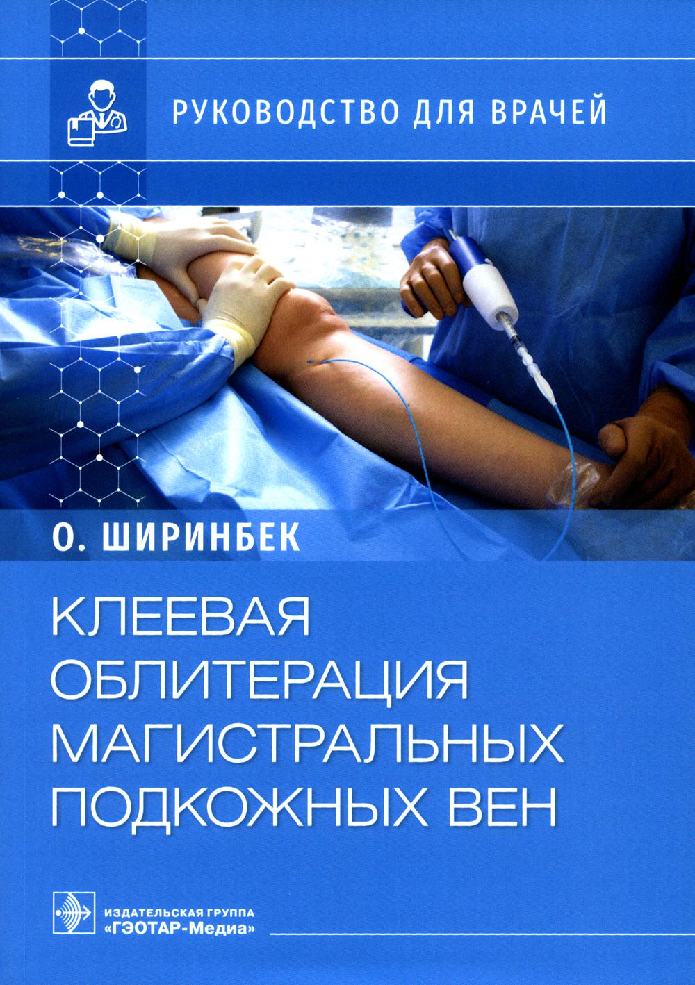 

Клеевая облитерация магистральных подкожных вен