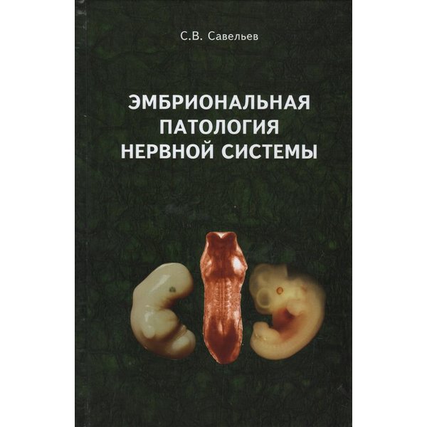 фото Книга эмбриональная патология нервной системы. савельев с.в. вече