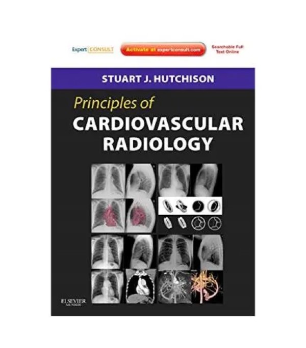 

Principles of Cardiovascular Radiology,. Stuart J. Hutchison