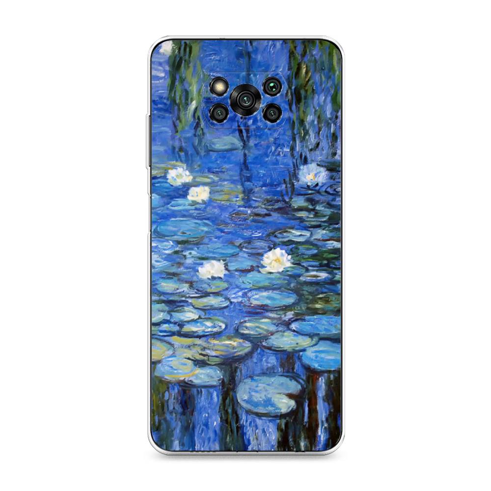 

Чехол на Xiaomi Poco X3 "Нарисованный пруд", Синий;зеленый, 310650-4