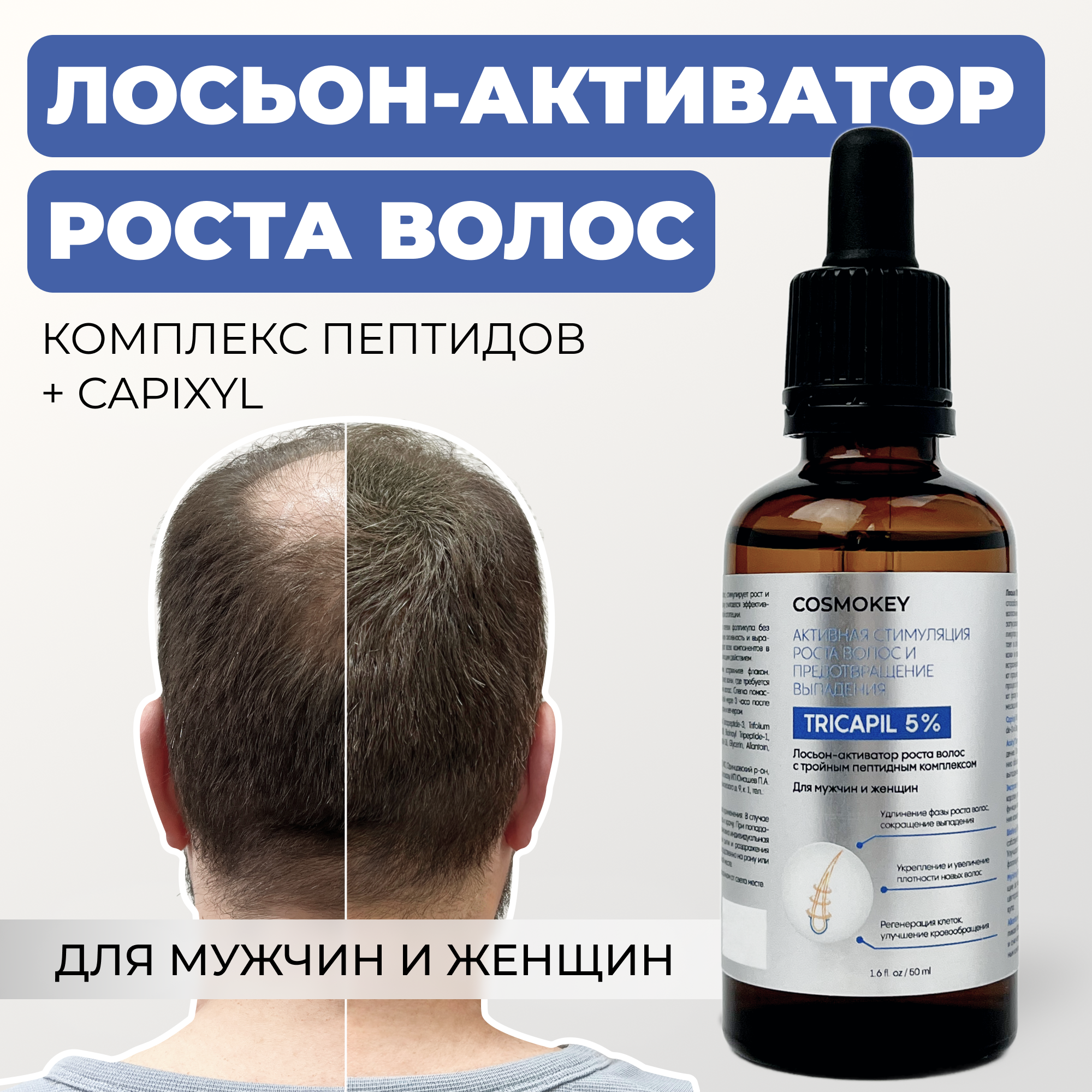 

Лосьон-активатор роста волос Cosmokey Tricapil 5% с тройным пептидным комплексом 50 мл