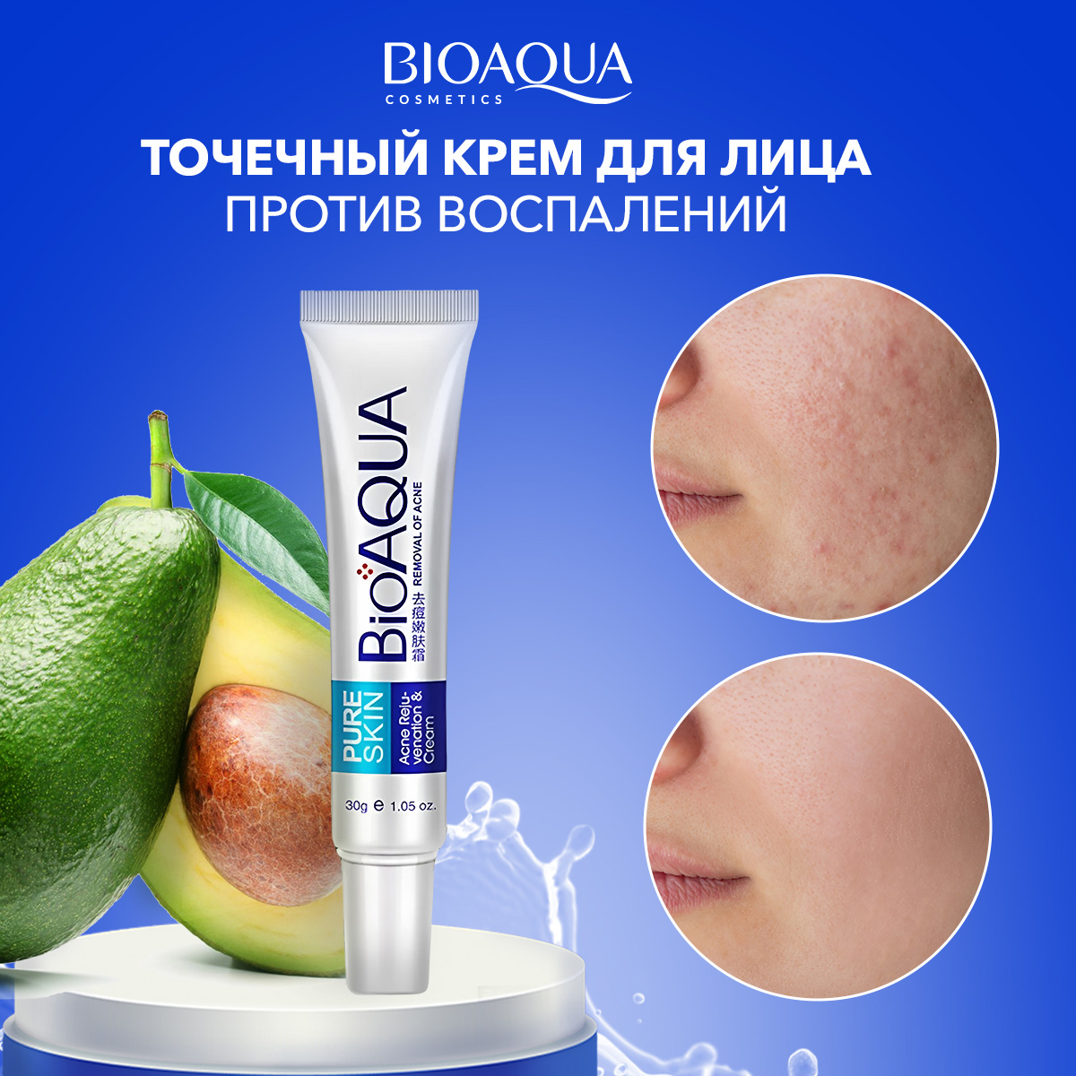 Крем BioAqua Pure Skin Removal Of Acne 30 мл