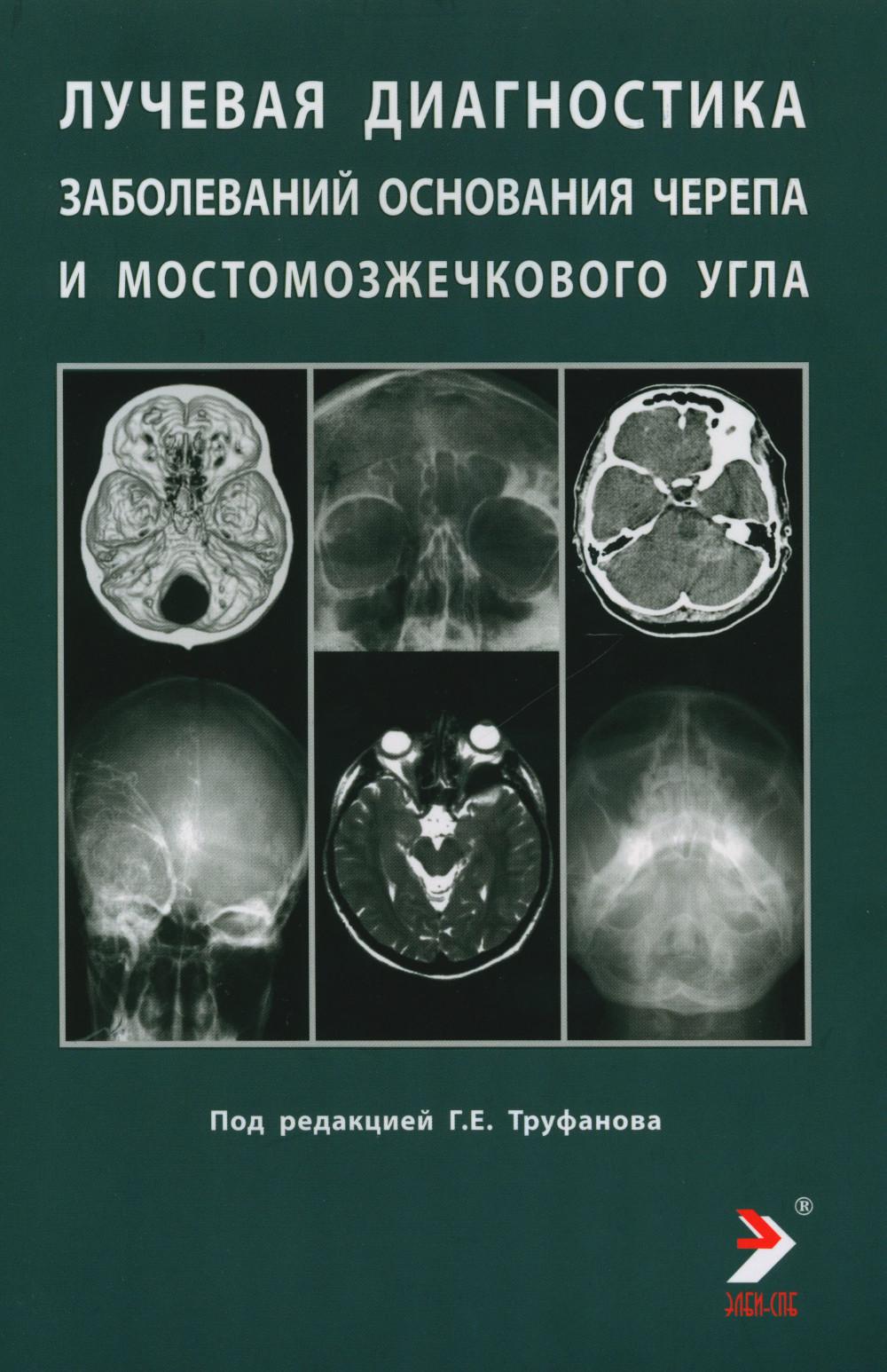 

Лучевая диагностика заболеваний оснований черепа и мостмозжечкового угла