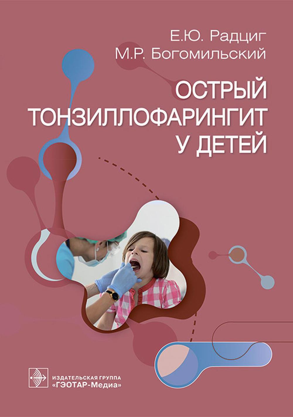 

Острый тонзиллофарингит у детей