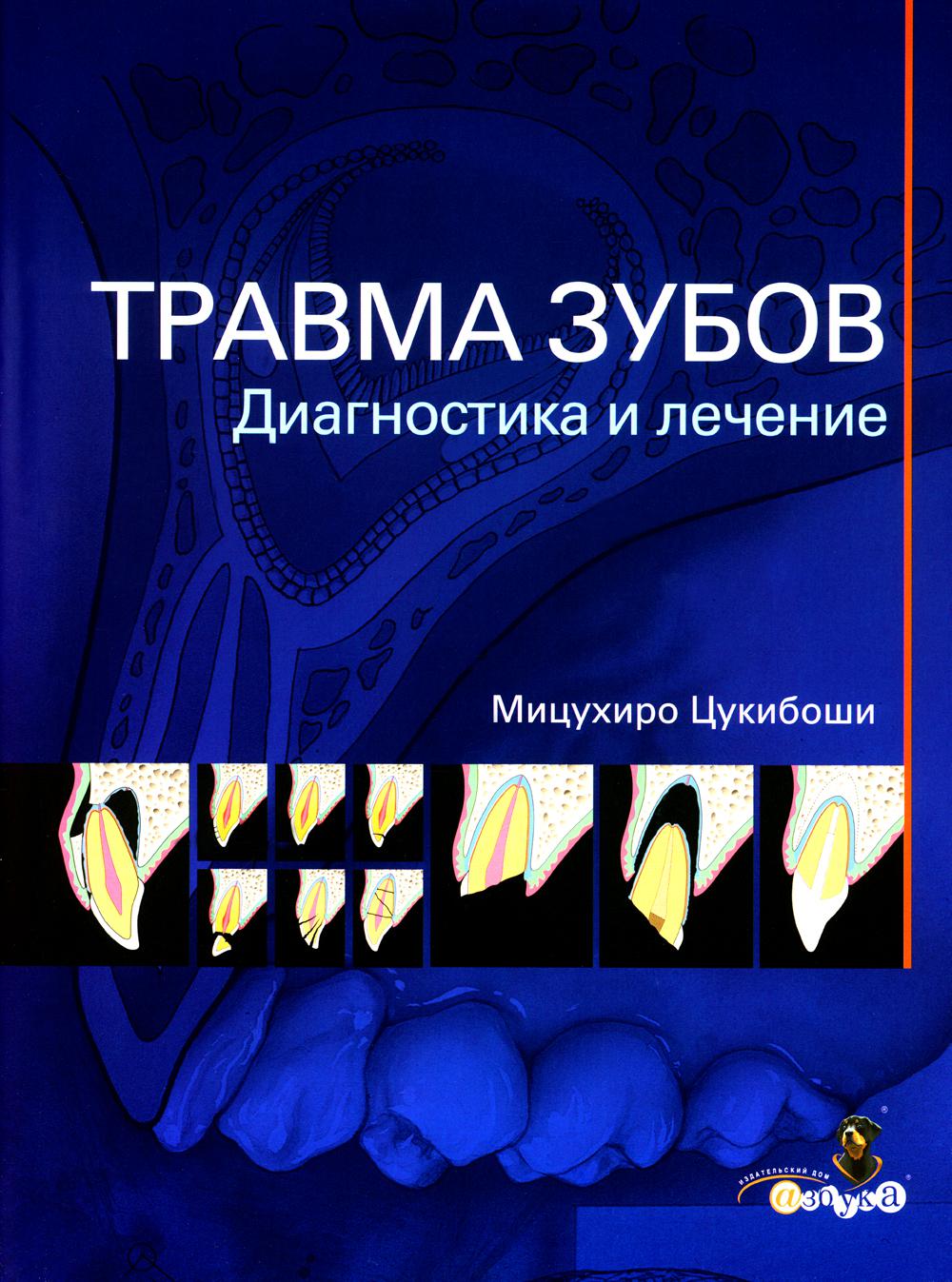 

Травма зубов. Диагностика и лечение