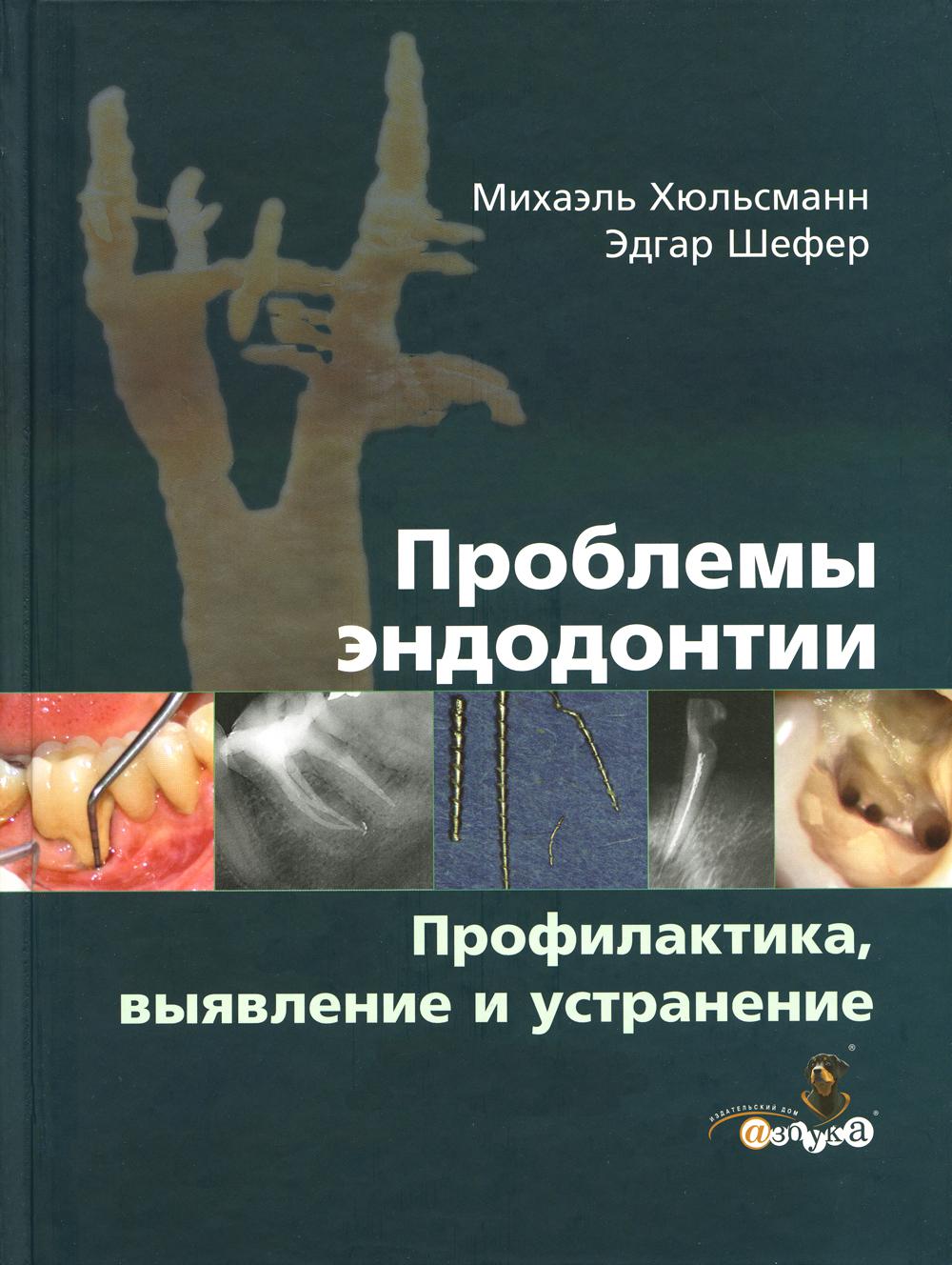 

Проблемы эндодонтии. Профилактика, выявление и устранение