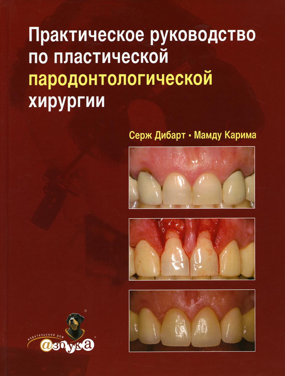 

Практическое руководство по пластической парадонтологической хирургии