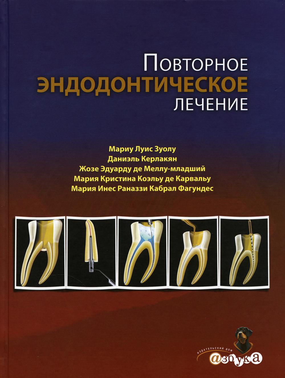 

Повторное эндодонтическое лечение