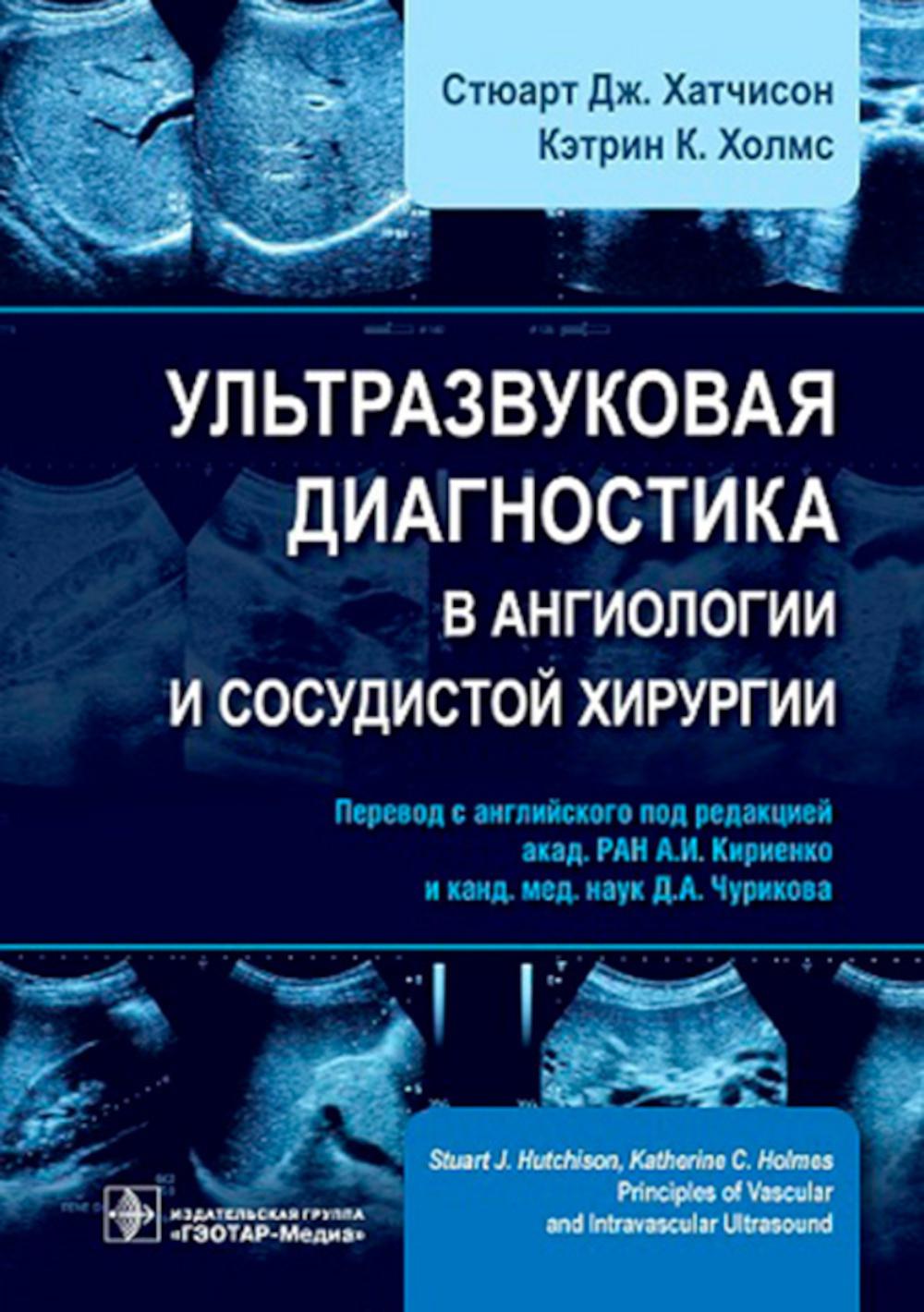 

Ультразвуковая диагностика в ангиологии и сосудистой хирургии