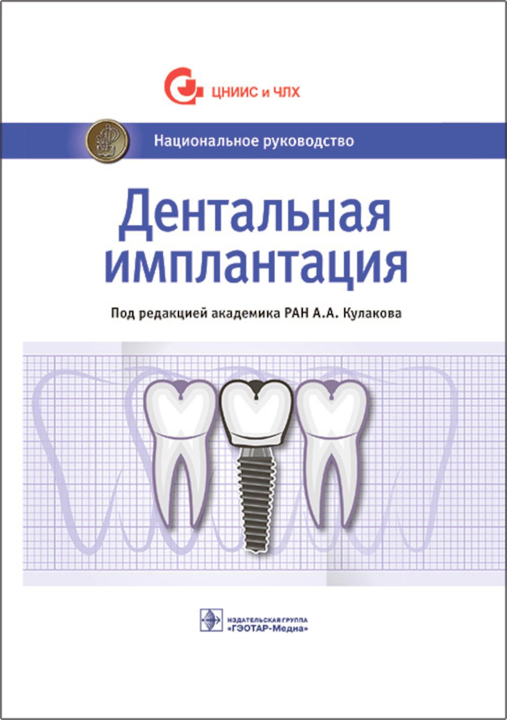 

Дентальная имплантация: национальное руководство