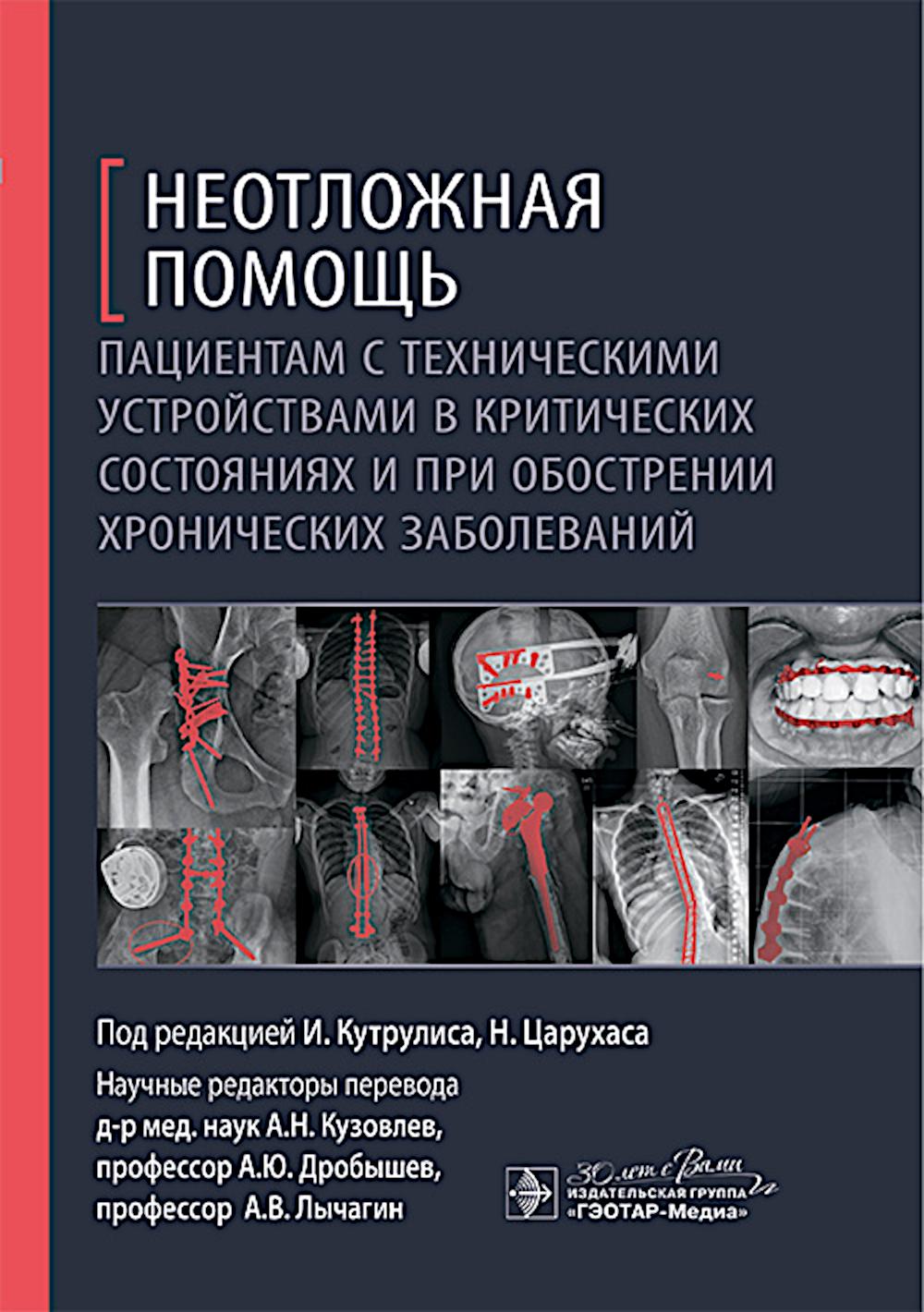 

Неотложная помощь пациентам с техническими устройствами в критических состояниях