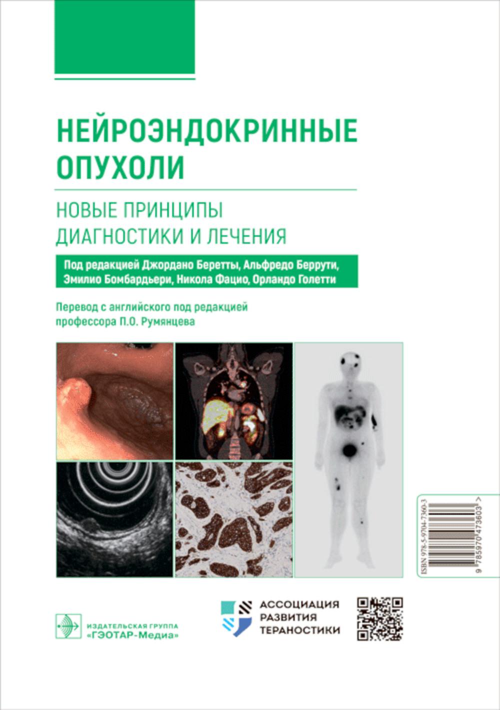 

Нейроэндокринные опухоли. Новые принципы диагностики и лечения: руководство для в...