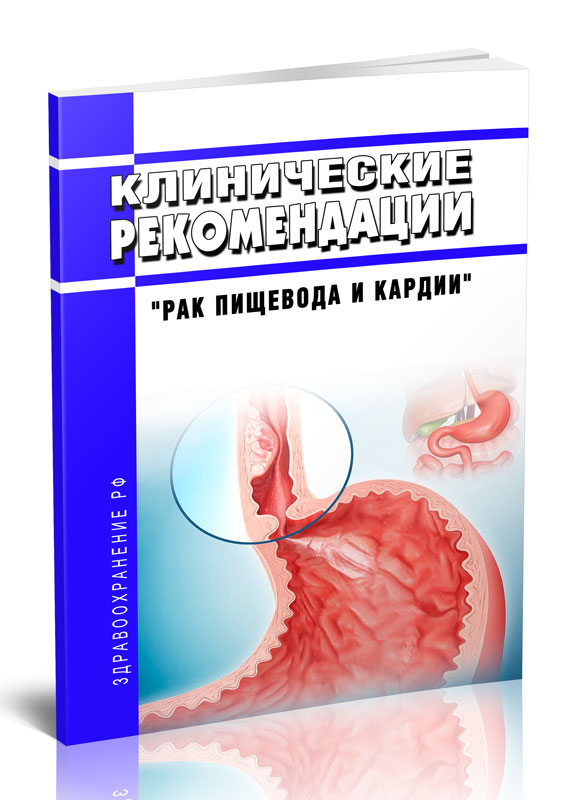 

Клинические рекомендации Рак пищевода и кардии Взрослые