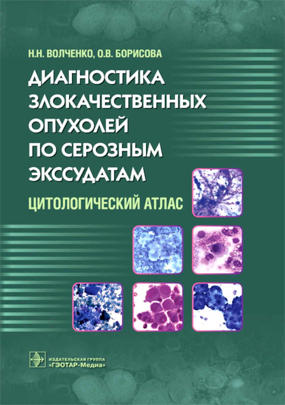 

Книга Диагностика злокачественных опухолей по серозным экссудатам