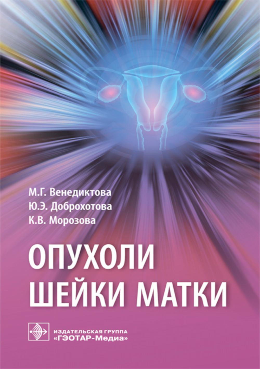 

Опухоли шейки матки