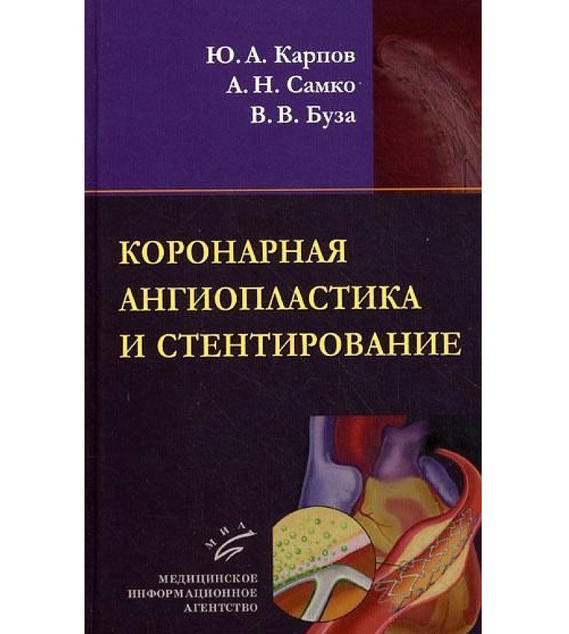 

Коронарная ангиопластика и стентирование