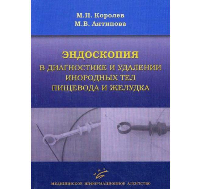 

Эндоскопия в диагностике и удалении инородных тел пищевода и желудка