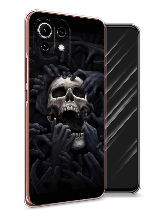 

Чехол Awog на Xiaomi Mi 11 Lite "Череп 29", Разноцветный, 310250-9