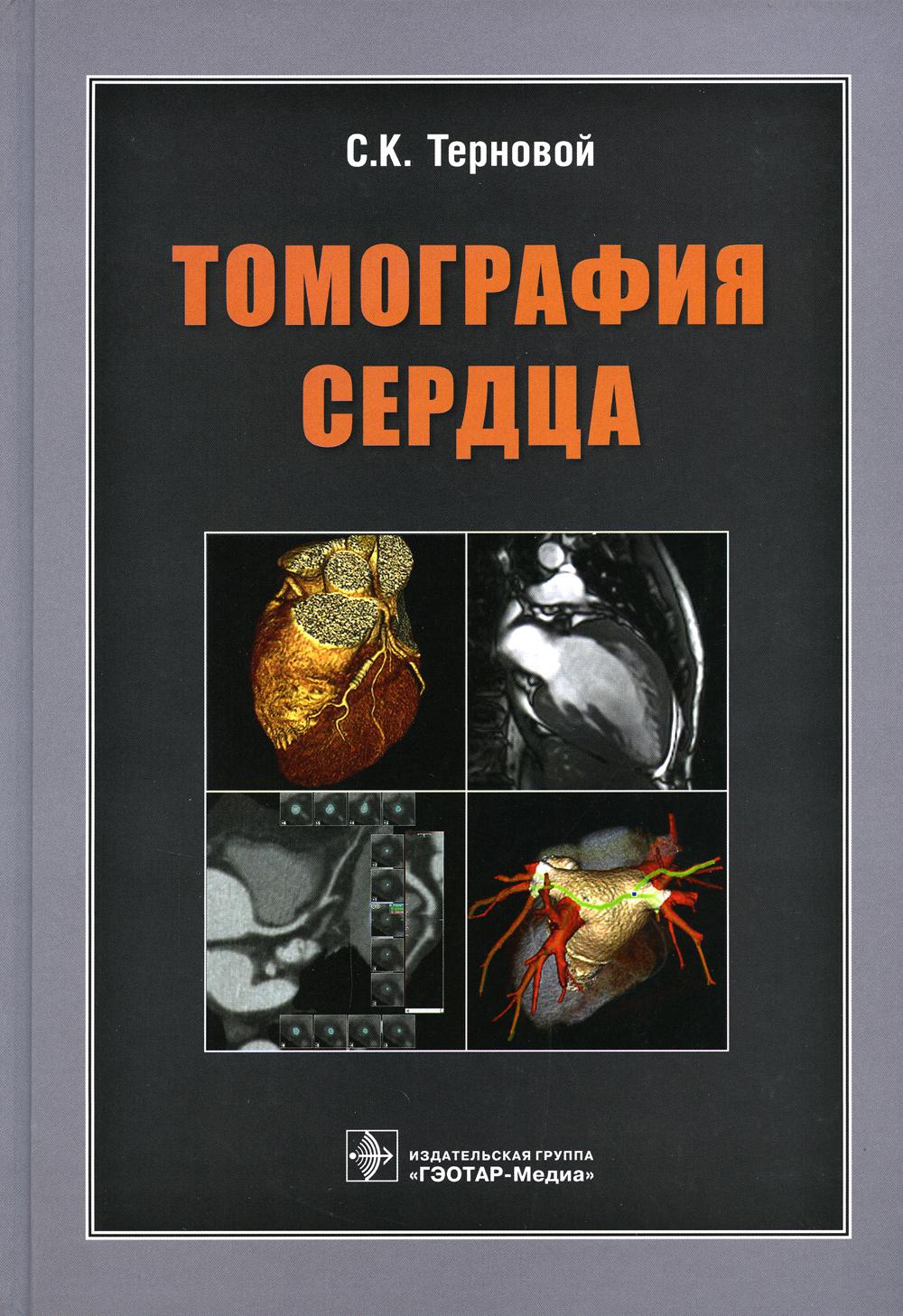 фото Книга томография сердца гэотар-медиа