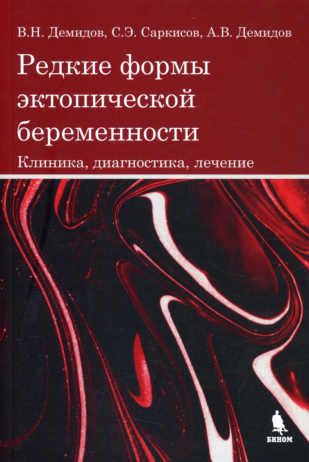 

Редкие формы эктопической беременности. Клиника, диагностика, лечение