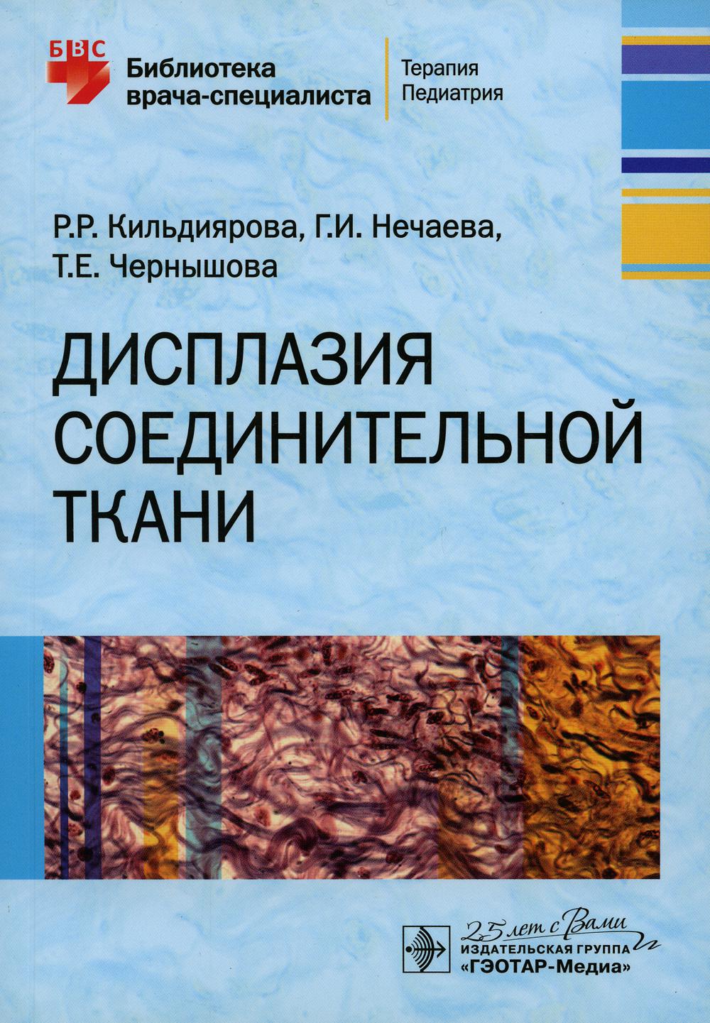 Дисплазия соединительной ткани это. Дисплазия соединительной ткани. ДСТ дисплазия соединительной ткани. Дисплазия соединительной ткани книга. Недифференцированная дисплазия соединительной ткани.