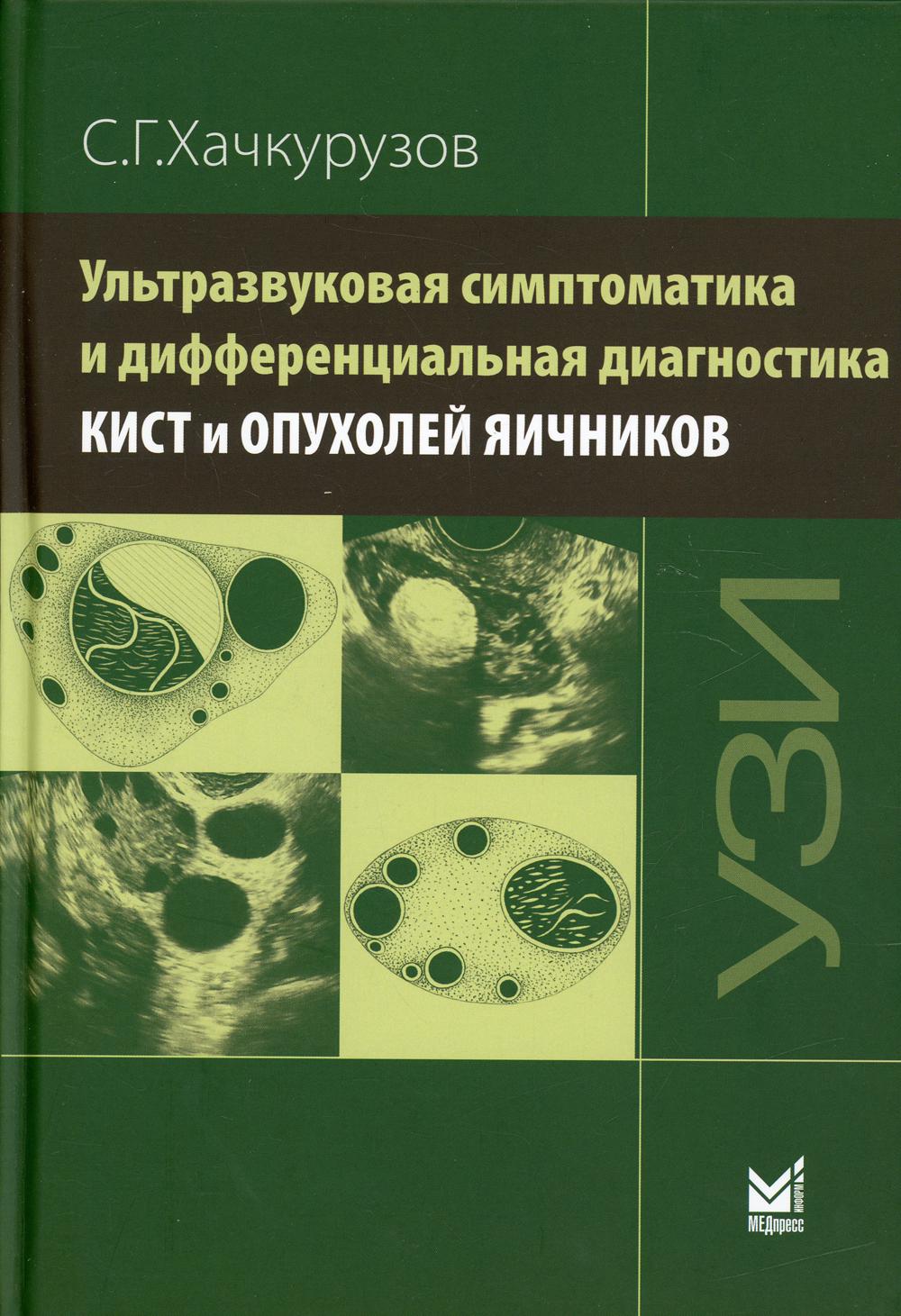 

Ультразвуковая симптоматика и дифференциальная диагностика кист и опухолей яичников