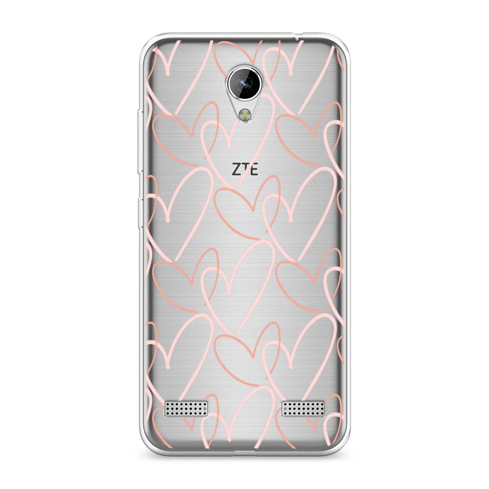 

Чехол на ZTE Blade A520 "Узор из сердечек", Розовый;бежевый, 132050-6
