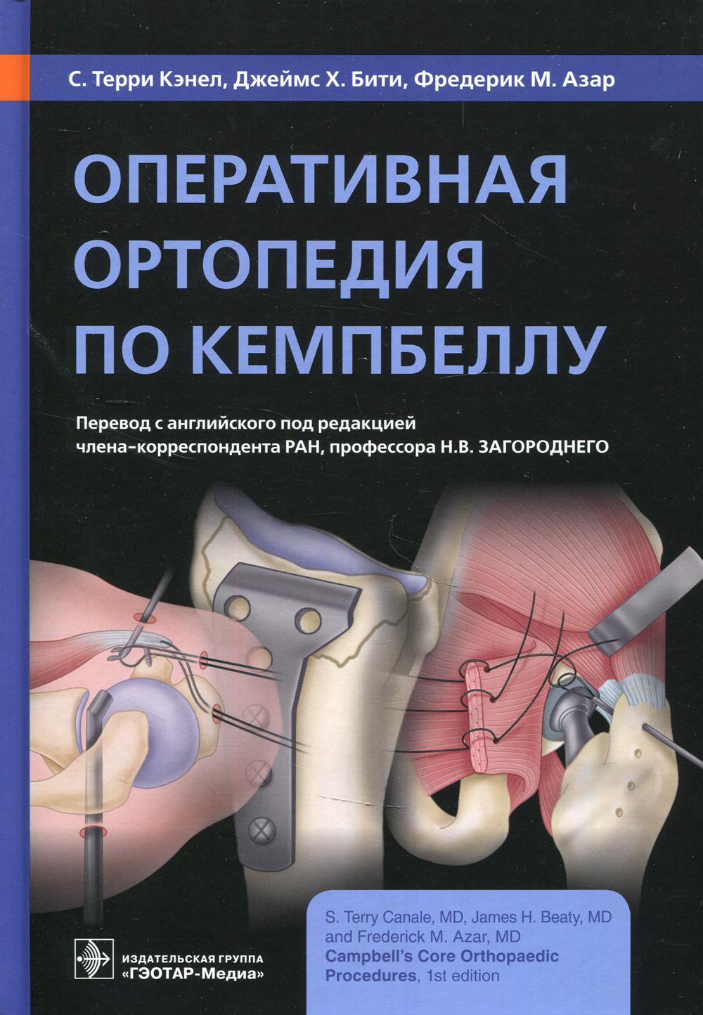 

Оперативная ортопедия по Кемпбеллу