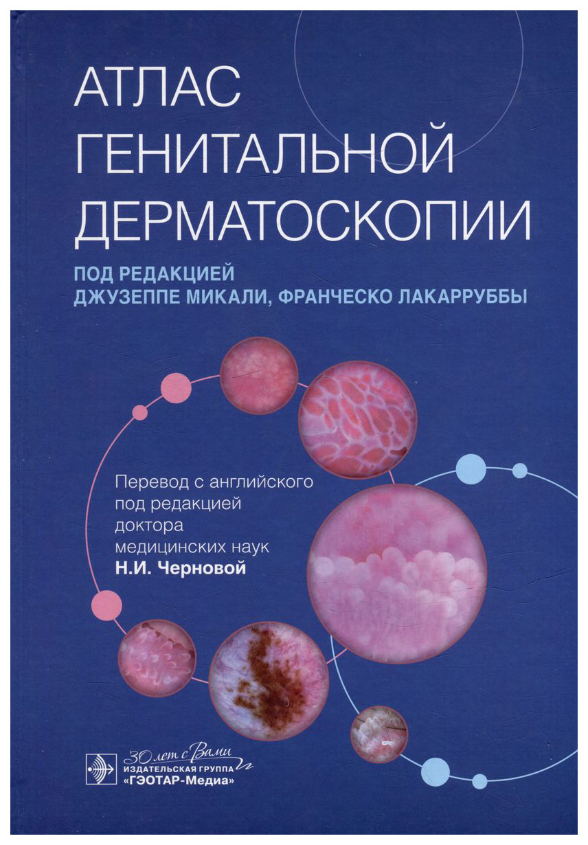 

под ред.Микали Дж.,Лакарруббы Ф.Атлас генитальной дерматоскопии, ОБРАЗОВАНИЕ И НАУКА