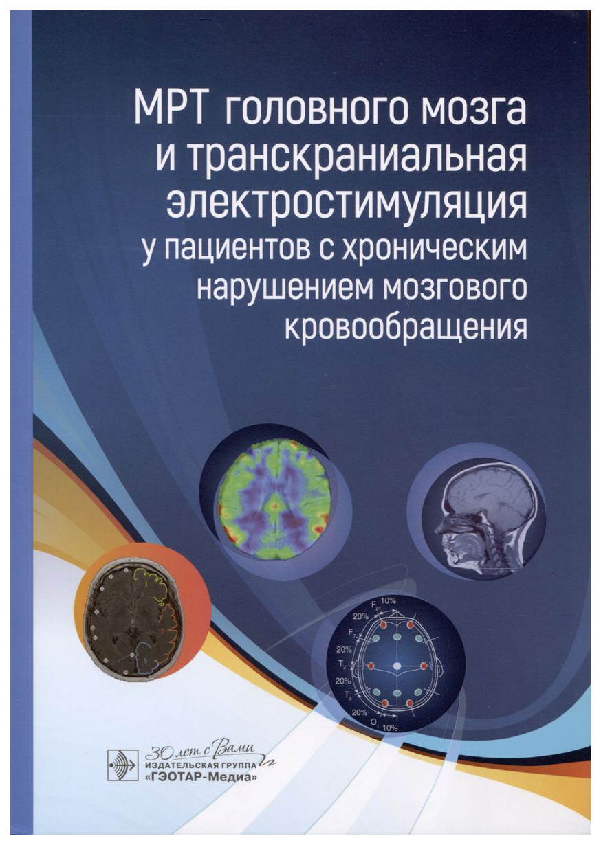 

МРТ головного мозга и транскраниальная электростимуляц.у пациентов с хронич.нар., ОБРАЗОВАНИЕ И НАУКА