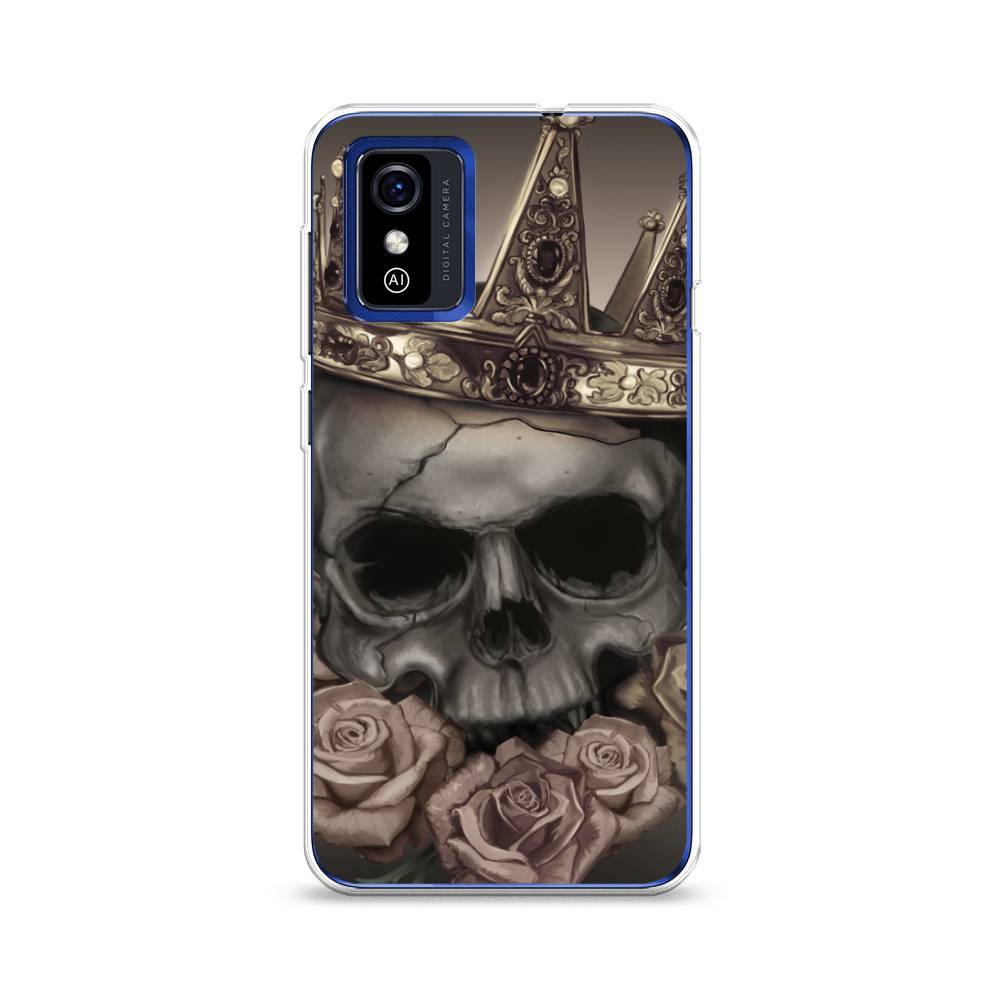 

Чехол Awog на ZTE Blade L9 / ЗТЕ Блэйд L9 "Череп 22", Разноцветный, 135250-9