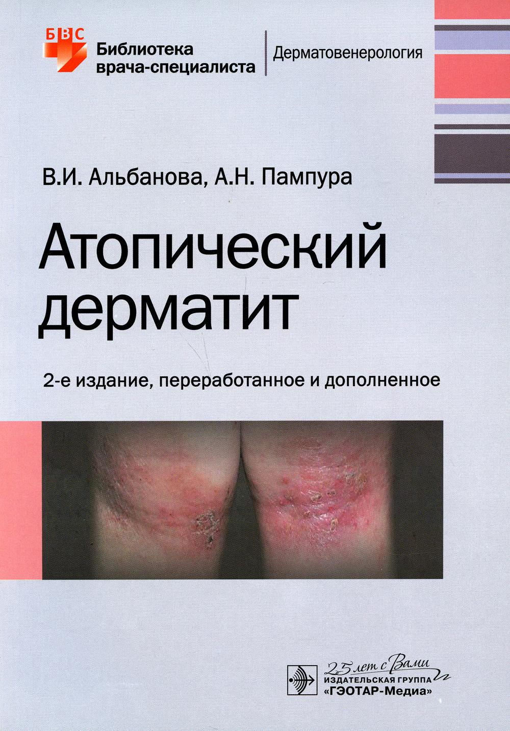 фото Книга атопический дерматит. 2-е изд., перераб. и доп гэотар-медиа