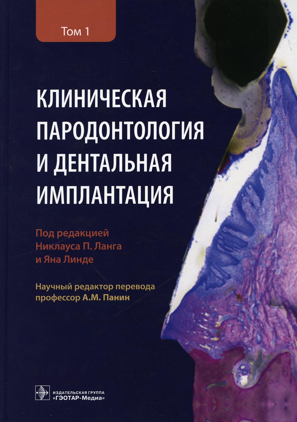 фото Книга клиническая пародонтология и дентальная имплантация: в 2-х т. т. 1 гэотар-медиа