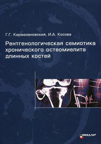 фото Книга рентгенологическая семиотика хронического остеомиелита длинных костей видар-м