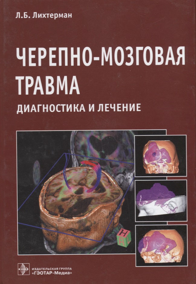 

Книга Черепно-мозговая травма. Монография / Лихтерман Л.Б.