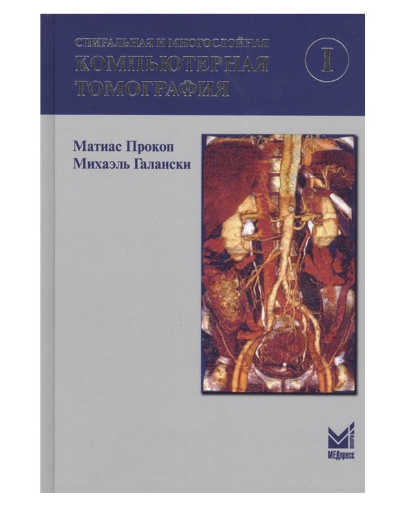 

Книга Спиральная и многослойная КТ Т.1 / Прокоп М., Галански М.