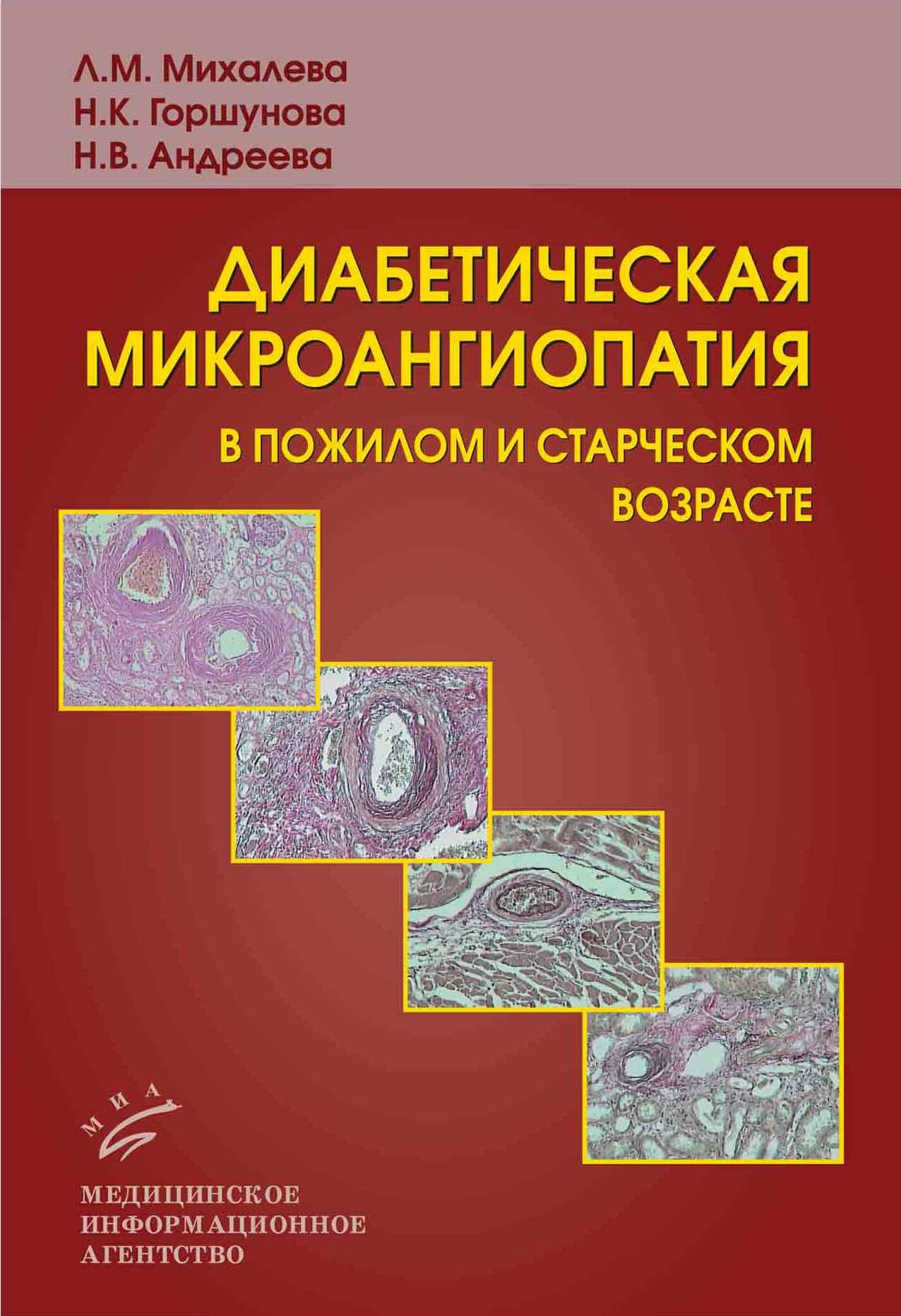 

Книга Диабетическая микроангиопатия в пожилом и старческом возрасте: Клинико-морфологич...