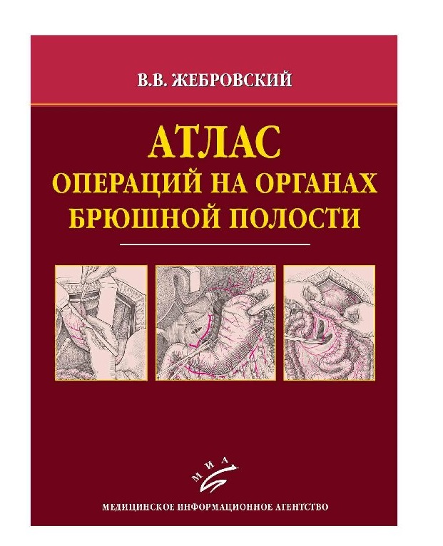 

Атлас операций на органах брюшной полости / Жебровский В.В
