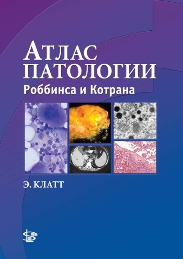 фото Книга атлас патологии роббинса и котрана / клатт э.к. логосфера