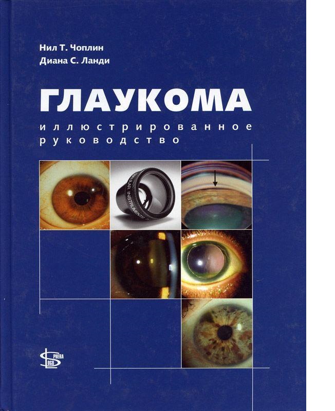 

Глаукома: иллюстрированное руководство / Чоплин, Ланди