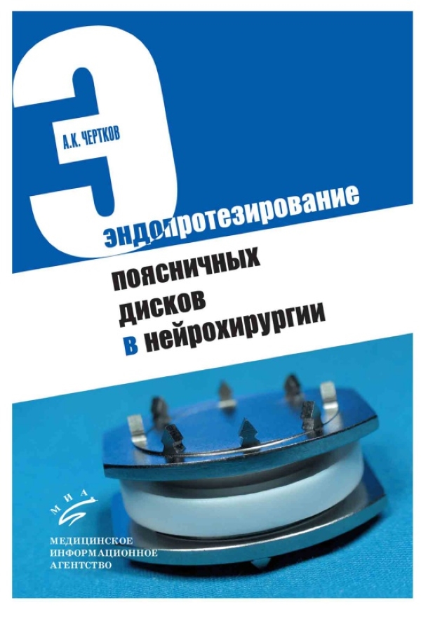 

Книга Эндопротезирование поясничных дисков в нейрохирургии / Чертков А.К